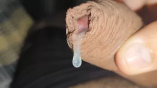Incredible Cock, Unique of Slippery Phimosis by the Robust Body.
