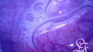 I really love taking a look into my deepest insides!