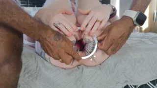 Anal Dilation Makes My Ass Folds Burst