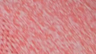 Melove Showing her Hairy Armpits and her...