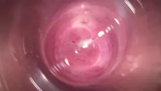 Camera deep inside Mia's tiny creamy vagina