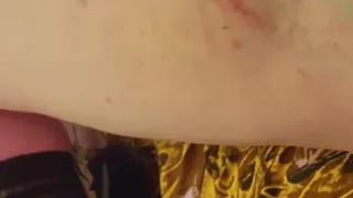 Fisting Freak