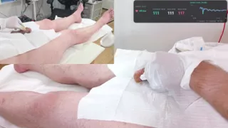Calm and smooth 18 French Foley Insertion