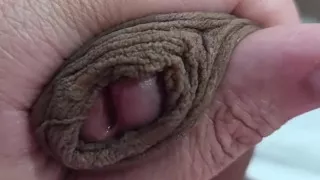 The Head of My Penis