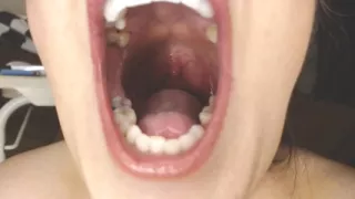 Throat and Mouth Spit Strings Uvula Tonsils Uvula