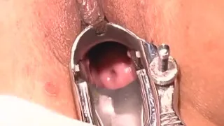 Wild Experience at Gyno