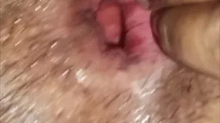 Deephole