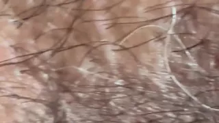 Closeup of Penis with One Vein