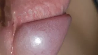 Amazing Upright Rough Venous Frenulum