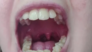 Throat Fetish