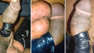 Virginia surgery gone wrong