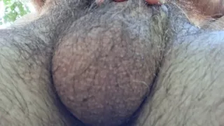Hairy balls