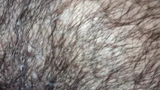 Suck My Hairy Pointy Nipples