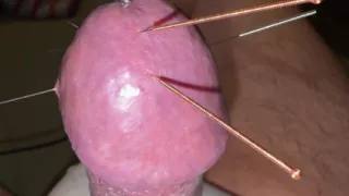 Acupuncture - Orgasm!