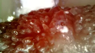 Medical Endoscope Oral Exam: Gummy Chewing, Extreme Teeth & Tongue Macro