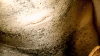 Honey masage