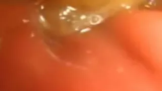Inside Me the Journey of the Orange