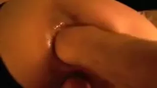 Anal Fisting