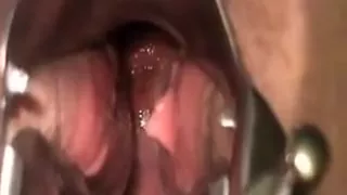 Cervix Cunt Contractions While Rubing Clit
