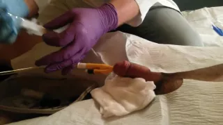 Me getting a Catheter from the Doctor