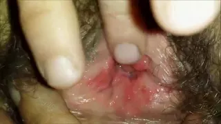 Teasing a hairy teen pussy - Closeup