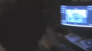 The Blakanian way of giving head