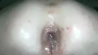 stretching creampie rectal hole
