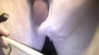 mein neues selbstgemachtes CBT und zwei Nadeln in meinen Balsen