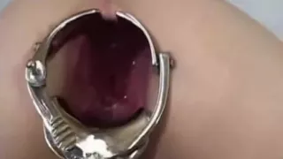 Non-Professional Bizarre Anal Sex