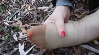 Girl Playing With Her Sprained Ankle in Bandage and Tan Nylon