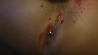 Torture and Burning of Jesus