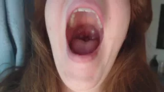 Woman yawning