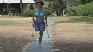 Amputee at the beach