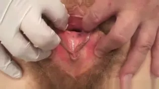 Unshaven pussy extreme Karla visits a doc