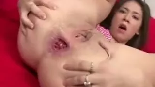 Russian Teen Anal Gape Compilation