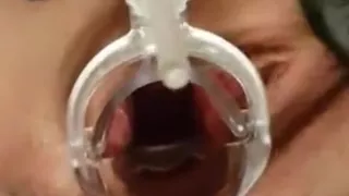 Magic at Mel's place, Vol 4 speculum exam, latex gloves.