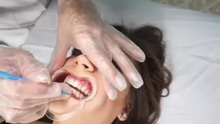 Rennee Dental play