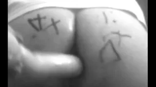 Dziurocholiczka Cz 4