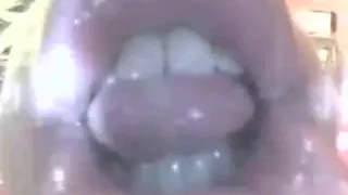 Mouthcam Missy