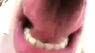 Mouthcam Deiree