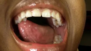 Swallowed by Delphine