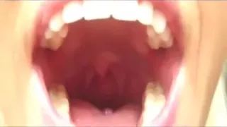 KinkiNikki4 Uvula and Throat