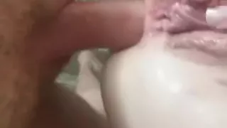 Giving mottled skin girl her first anal.