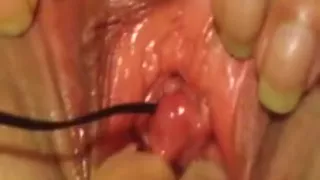 Vibrating Egg in pee hole
