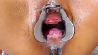 speculum pussy