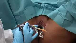 Best homemade Fetish porn movie