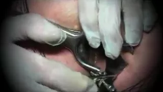 Male sissy speculum anal pantyhose nylon toy