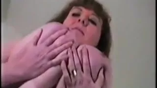 Huge tits macromastia vintage from 1984