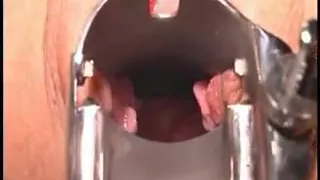 Nurse have a look inside my snatch PT2 DMvideos