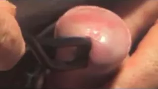 Mann sondiert die Harnröhre mit einem Kabel